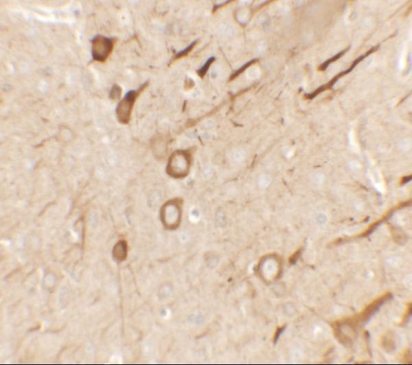 Immunohistochemistry of PRRT2 in rat brain tissue with PRRT2 antibody at 2