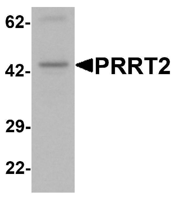 Western blot analysis of PRRT2 in mouse brain tissue lysate with PRRT2 antibody at 1 μg/mL
