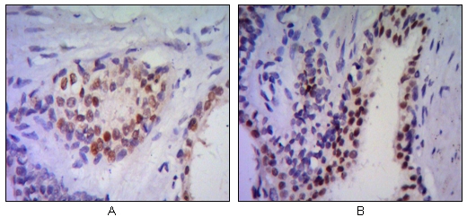 Immunohistochemistry (IHC) analysis of paraffin-embedded human prostata tissues (A, B) with DAB staining using Nkx-3