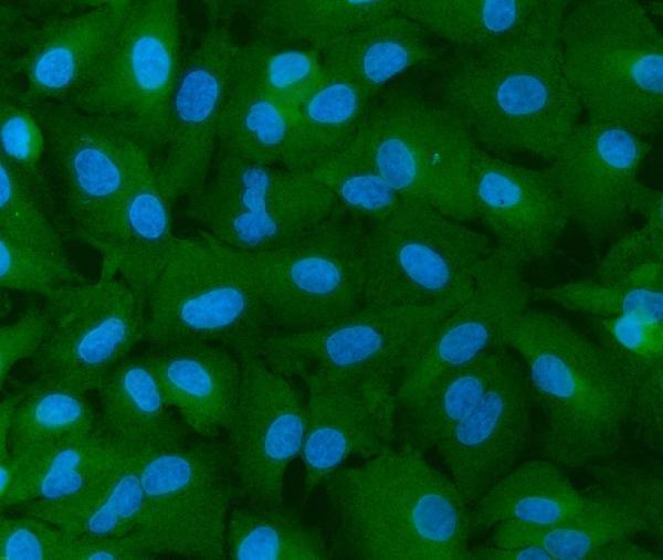 a02710 1 inf2 primary antibodies if testing 2