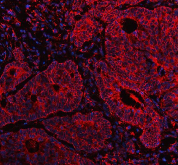 a02710 1 inf2 primary antibodies if testing 3