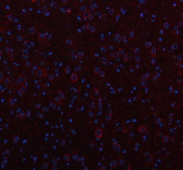 a02710 1 inf2 primary antibodies if testing 4
