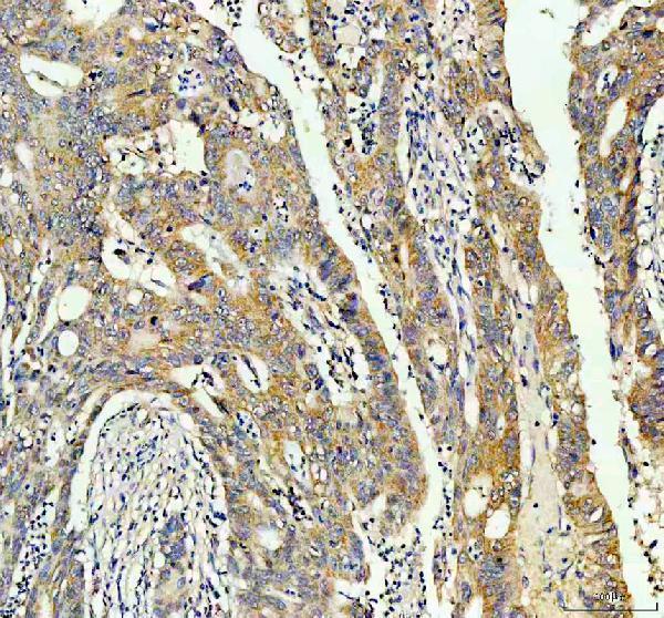 IHC analysis of INF2 using anti-INF2 antibody (A02710-1)