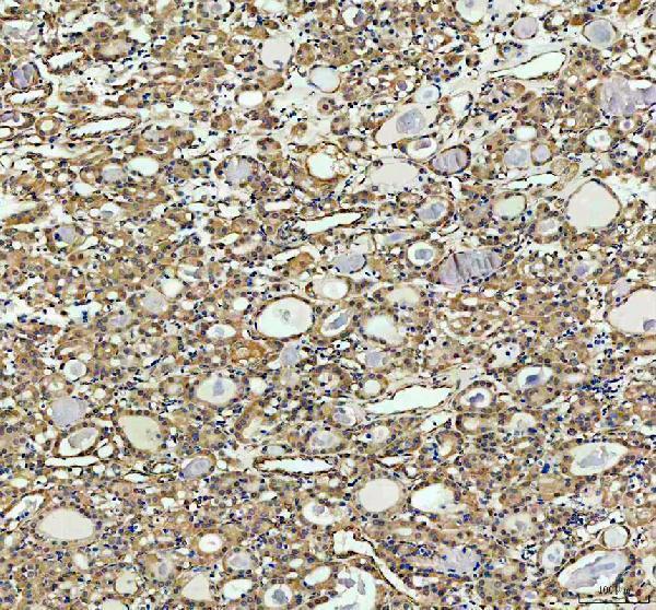 IHC analysis of INF2 using anti-INF2 antibody (A02710-1)