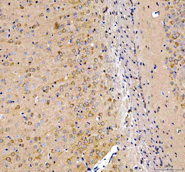 a02710 1 inf2 primary antibodies ihc testing 3