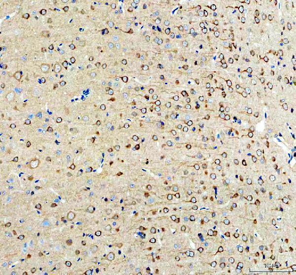 a02710 1 inf2 primary antibodies ihc testing 4