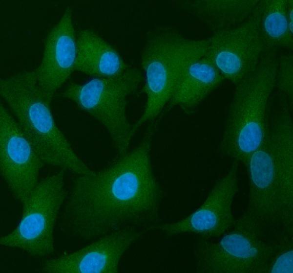 a02710 2 inf2 primary antibodies if testing 6