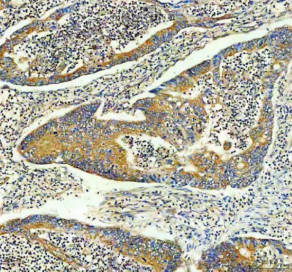  IHC analysis of INF2 using anti-INF2 antibody (A02710-2)