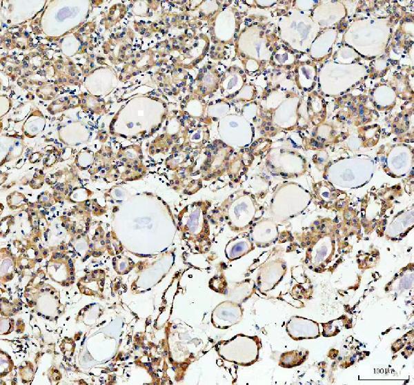 a02710 2 inf2 primary antibodies ihc testing 3