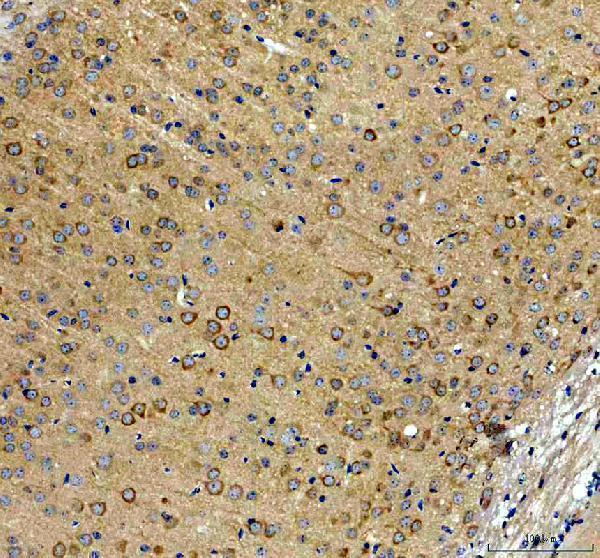 a02710 2 inf2 primary antibodies ihc testing 4
