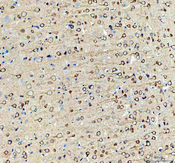 a02710 2 inf2 primary antibodies ihc testing 5