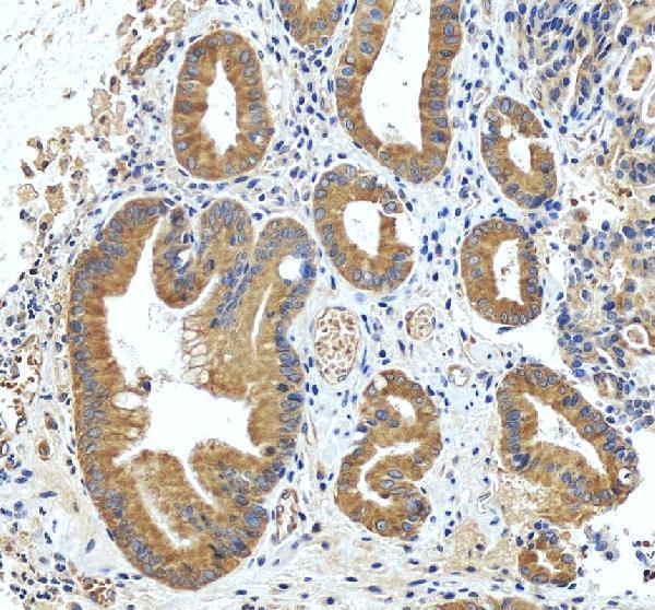 IHC analysis of INF2 using anti-INF2 antibody (A02710-2)