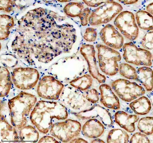 a02711 1 plxnb1 primary antibodies ihc testing 1