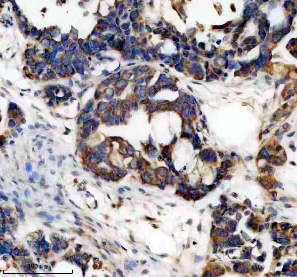 a02711 1 plxnb1 primary antibodies ihc testing 2