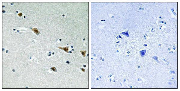 Immunohistochemistry analysis of paraffin-embedded human brain, using MAP2K7 (Phospho-Ser271) Antibody