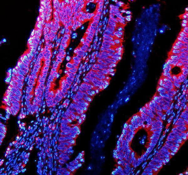 IF analysis of PDE4A using anti-PDE4A antibody (A02714-1)