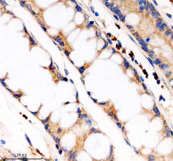 IHC analysis of PDE4A using anti-PDE4A antibody (A02714-1)