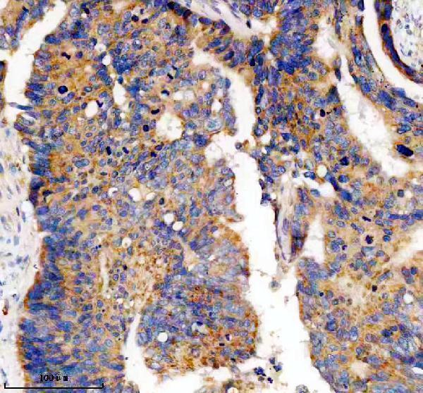 IHC analysis of PDE4A using anti-PDE4A antibody (A02714-1)