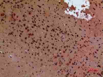 a02715 abl2 primary antibodyes ihc testing 2