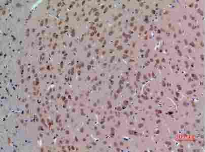 a02715 abl2 primary antibodyes ihc testing 3