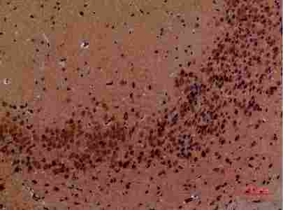 a02715 abl2 primary antibodyes ihc testing 4