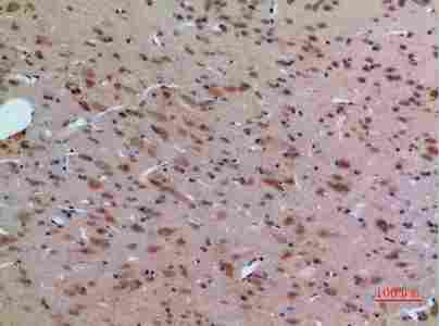 a02715 abl2 primary antibodyes ihc testing 5