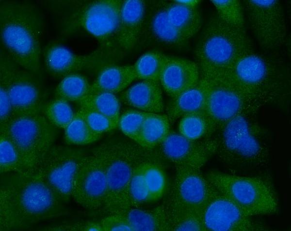 a02716 1 ank1 primary antibodies if testing 5