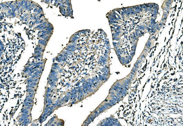  IHC analysis of Ankyrin Erythroid/ANK/ANK1 using anti-Ankyrin Erythroid/ANK/ANK1 antibody (A02716-1)