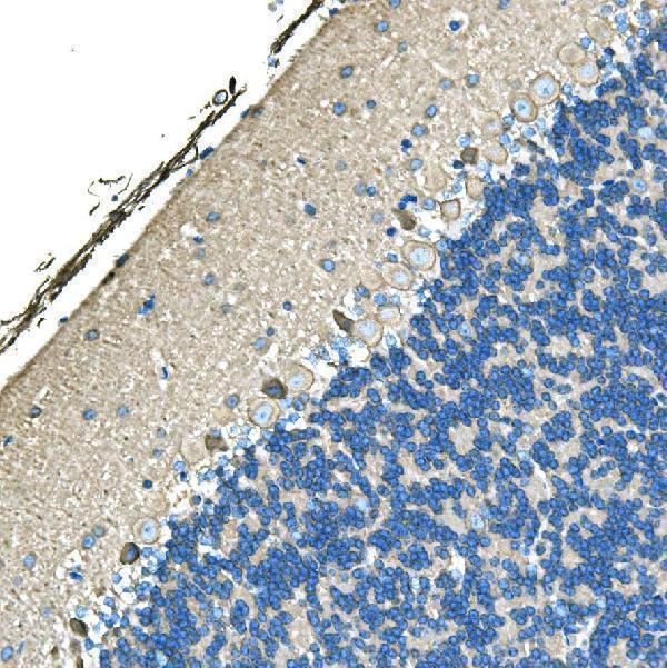  IHC analysis of Ankyrin Erythroid/ANK/ANK1 using anti-Ankyrin Erythroid/ANK/ANK1 antibody (A02716-1)