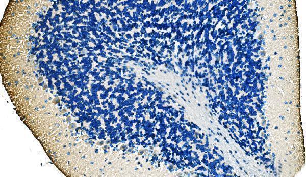 a02716 1 ank1 primary antibodies ihc testing 4_1