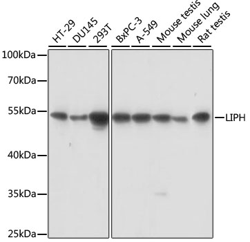 Western blot analysis of extracts of various cell lines, using LIPH antibody  at 1:1000 dilution
