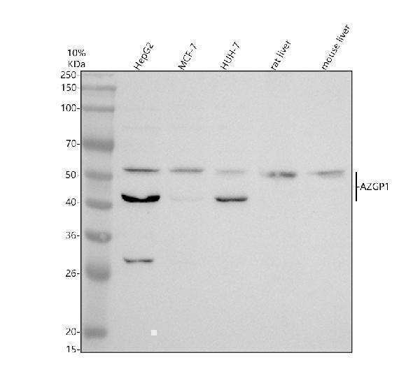 Western blot analysis of Zinc Alpha 2 Glycoprotein/AZGP1 using anti-Zinc Alpha 2 Glycoprotein/AZGP1 antibody (A02718-1)