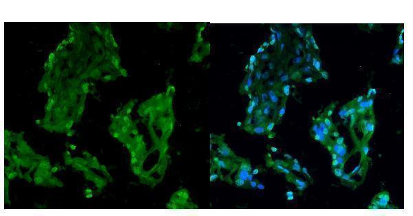 a02719 1 rcc1 primary antibodies if testing 7