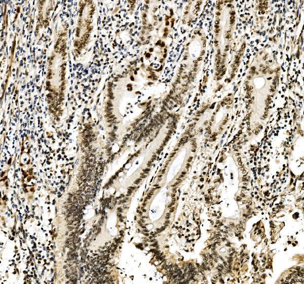 a02719 1 rcc1 primary antibodies ihc testing 2_1