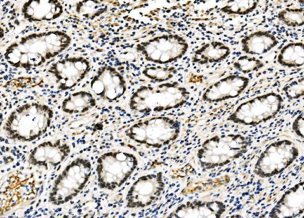 a02719 1 rcc1 primary antibodies ihc testing 3_1