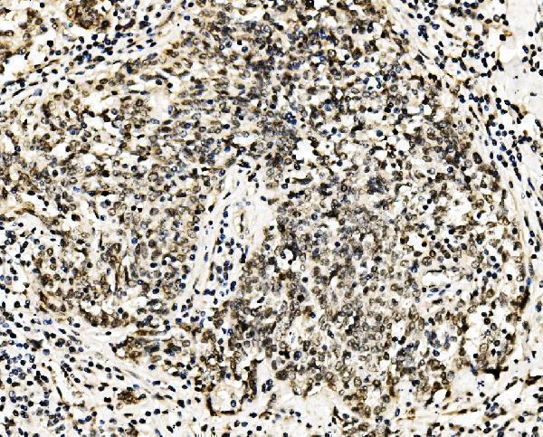 a02719 1 rcc1 primary antibodies ihc testing 4