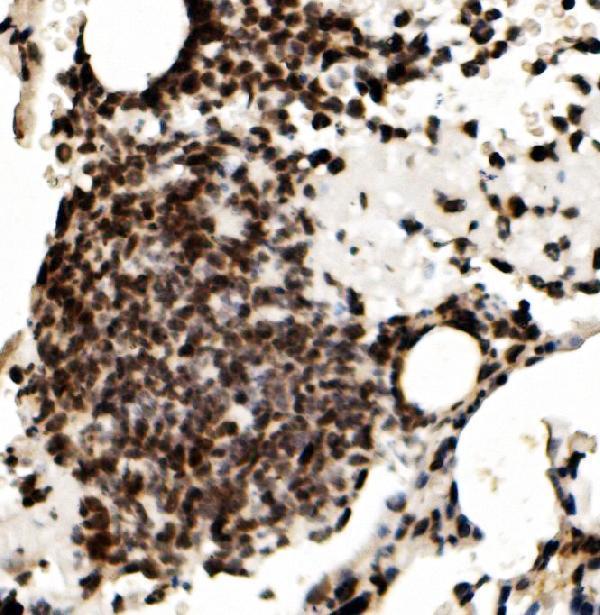 a02719 1 rcc1 primary antibodies ihc testing 5