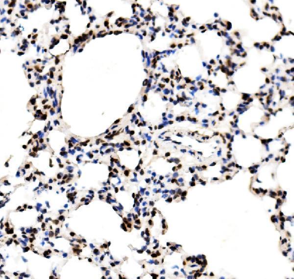 a02719 1 rcc1 primary antibodies ihc testing 6