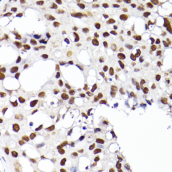 a02719 rcc1 primary antiboties ihc testing 2