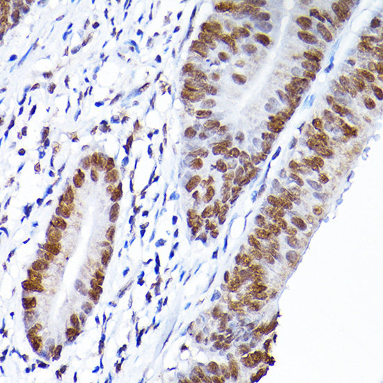 a02719 rcc1 primary antiboties ihc testing 3
