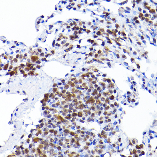 a02719 rcc1 primary antiboties ihc testing 4