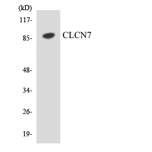 Western blot analysis of the lysates from COLO205 cells using CLCN7 antibody