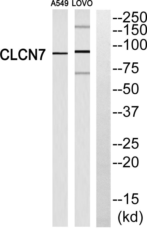 Western blot analysis of CLCN7 Antibody