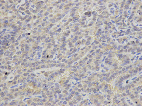 a02721 1 aprt primary antiboties ihc testing 2