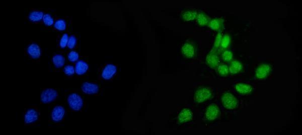 a02721 aprt primary antibodies if testing 2