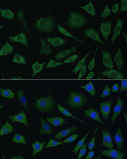 Immunofluorescence analysis of L929 cells using BMPR1B antibody  at dilution of 1:100