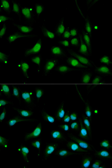 Immunohistochemistry of paraffin-embedded rat ovary using BMPR1B Rabbit pAb  at dilution of 1:350 
