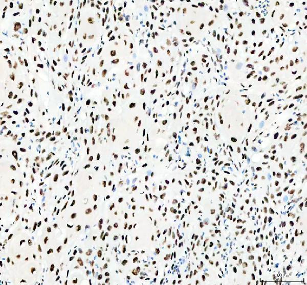 IHC analysis of HNRNPC using anti-HNRNPC antibody (A02726-1)