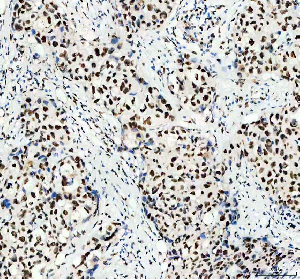 IHC analysis of HNRNPC using anti-HNRNPC antibody (A02726-1)