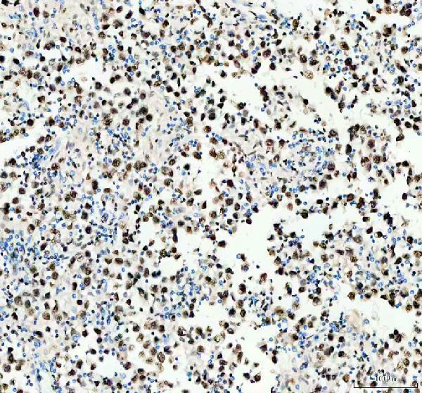 a02726 1 hnrnpc primary antibodies ihc testing 3